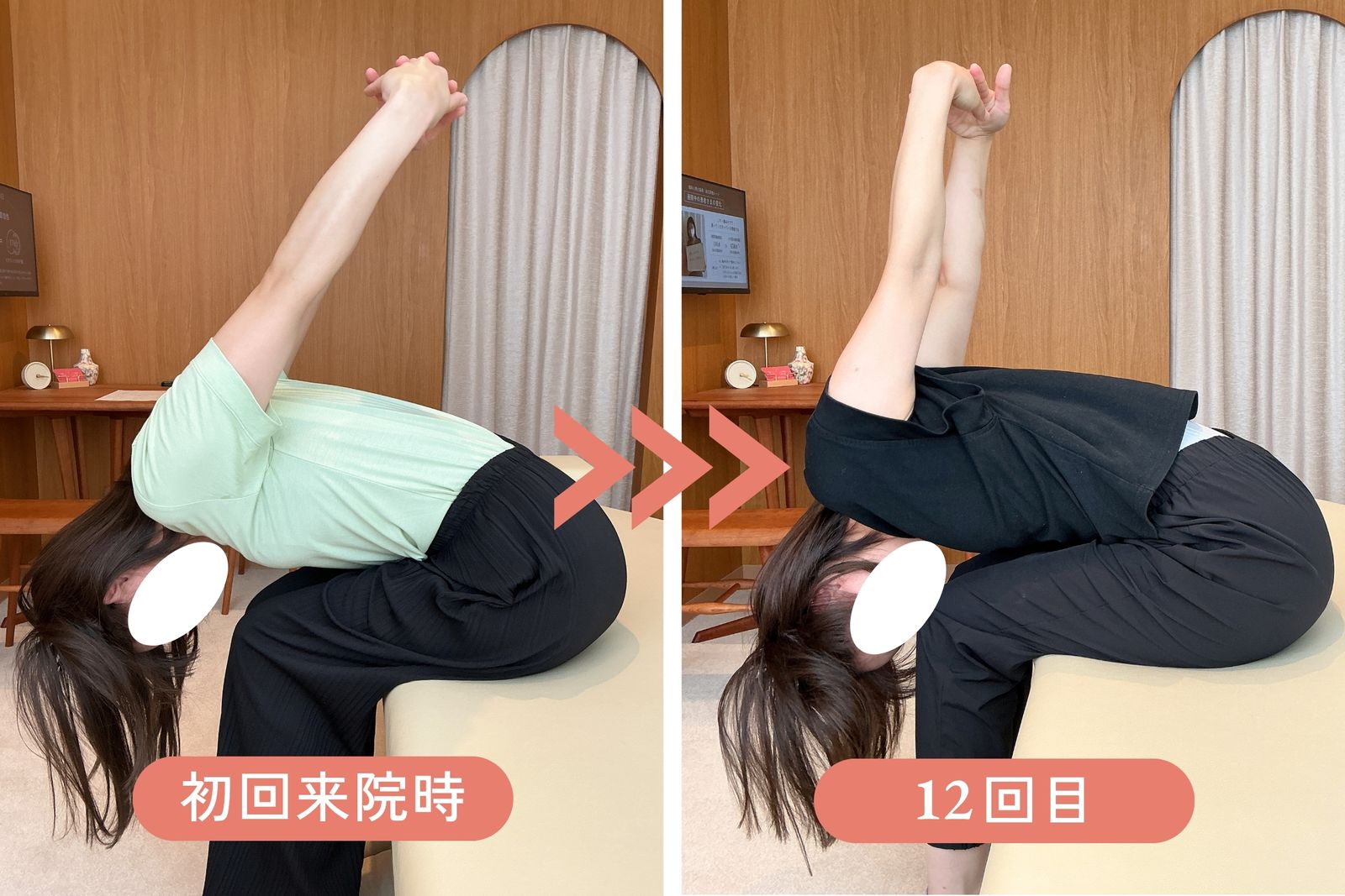 座った姿勢で両腕を上げ、前に身体を倒す動きの比較。初回来院時と12回目